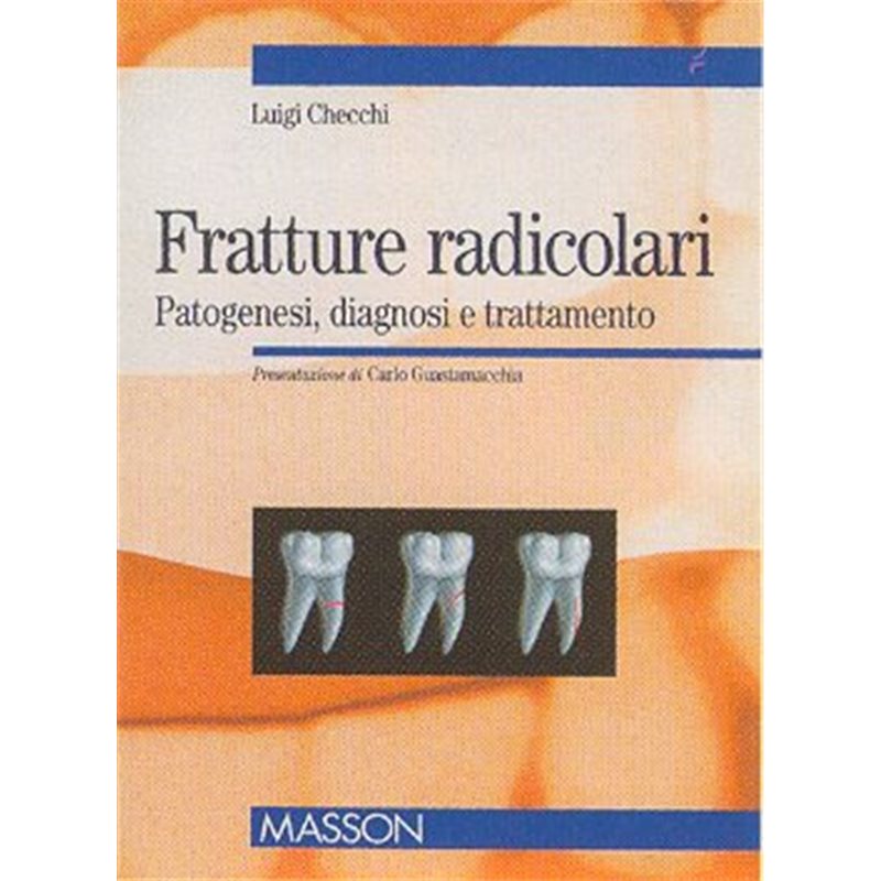 Fratture radicolari - PATOGENESI, DIAGNOSI E TRATTAMENTO